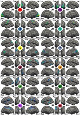Mind-Body Practice Changes Fractional Amplitude of Low Frequency Fluctuations in Intrinsic Control Networks